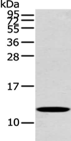 Gel: 12%SDS-PAGE, Lysate: 40 μg, Lane: Mouse heart tissue, Primary antibody: PFDN6 Antibody(PFDN6 Antibody) at dilution 1/250 dilution, Secondary antibody: Goat anti rabbit IgG at 1/8000 dilution, Exposure time: 20 secondsRabbit anti-Human PFDN6 Polyclonal Antibody