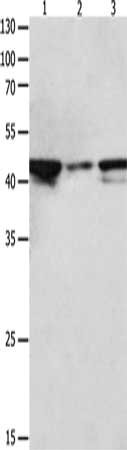Gel: 10%SDS-PAGE, Lysate: 40 μg, Lane 1-3: Hela cells, NIH/3T3 cells, Jurkat cells, Primary antibody: MAP2K2 Antibody(MAP2K2 Antibody) at dilution 1/1900, Secondary antibody: Goat anti rabbit IgG at 1/8000 dilution, Exposure time: 30 seconds