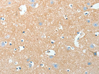 The image on the left is immunohistochemistry of paraffin-embedded Human brain tissue using the antibody Antibody) at dilution 1/15, on the right is treated with fusion protein. (Original magnification: ×200)Rabbit anti-Human AKAP7 Polyclonal Antibody
