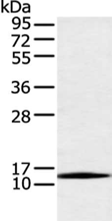 Gel: 12%SDS-PAGE, Lysate: 40 μg, Lane: Human bladder carcinoma tissue, Primary antibody: AKAP7 Antibody(AKAP7 Antibody) at dilution 1/200 dilution, Secondary antibody: Goat anti rabbit IgG at 1/8000 dilution, Exposure time: 30 secondsRabbit anti-Human AKAP7 Polyclonal Antibody
