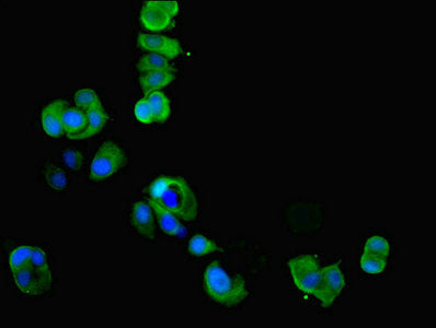 Immunofluorescent analysis of MCF-7 cells using CKMT1A Antibody at dilution of 1:100 and Alexa Fluor 488-congugated AffiniPure Goat Anti-Rabbit IgG(H+L)Rabbit anti-Human CKMT1A Polyclonal Antibody