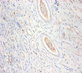 Immunohistochemistry of paraffin-embedded human kidney tissue using the antibody at dilution of 1:100Rabbit anti-Human CKMT1A Polyclonal Antibody