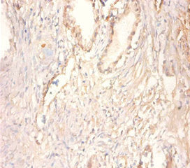 Immunohistochemistry of paraffin-embedded human prostate tissue using CKMT1A Antibody at dilution of 1:100Rabbit anti-Human CKMT1A Polyclonal Antibody