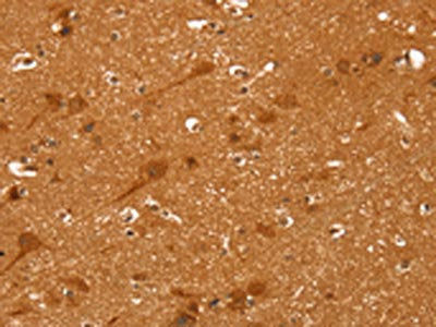 The image on the left is immunohistochemistry of paraffin-embedded Human brain  tissue using CCND2 Antibody(CCND2 Antibody) at dilution 1/25, on the right is treated with synthetic peptide. (Original magnification: ×200)Rabbit anti-Human CCND2 Polyclonal Antibody