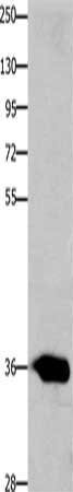 Gel: 10%SDS-PAGE, Lysate: 30 μg, Lane: 231 cells, Primary antibody: CCND2 Antibody(CCND2 Antibody) at dilution 1/200, Secondary antibody: Goat anti rabbit IgG at 1/8000 dilution, Exposure time: 5 minutesRabbit anti-Human CCND2 Polyclonal Antibody