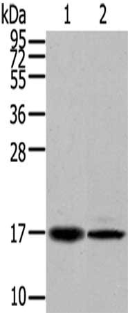 Gel: 12%SDS-PAGE,Lysate: 40 μg,Lane 1-2: Lovo cells, 231 cells,Primary antibody: TUSC5 Antibody(TUSC5 Antibody) at dilution 1/200 dilution,Secondary antibody: Goat anti rabbit IgG at 1/8000 dilution,Exposure time: 40 secondsRabbit anti-Human TUSC5 Polyclonal Antibody