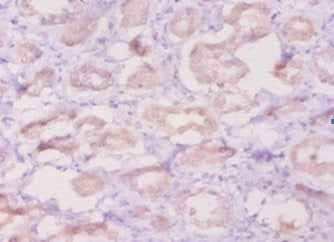 Immunohistochemistry of paraffin-embedded human kidney tissue using DEFB1 Antibody at dilution of 1:50Rabbit anti-Human DEFB1 Polyclonal Antibody