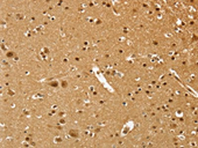 The image on the left is immunohistochemistry of paraffin-embedded Human brain  tissue using PSMC1 Antibody(PSMC1 Antibody) at dilution 1/40, on the right is treated with fusion protein. (Original magnification: ×200)Rabbit anti-Human PSMC1 Polyclonal Antibody