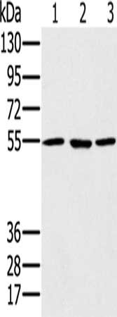 Gel: 8%SDS-PAGE, Lysate: 40 μg, Lane 1-3: A549 cells, hela cells, NIH/3T3 cells, Primary antibody: PSMC1 Antibody(PSMC1 Antibody) at dilution 1/500, Secondary antibody: Goat anti rabbit IgG at 1/8000 dilution, Exposure time: 20 secondsRabbit anti-Human PSMC1 Polyclonal Antibody