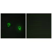 Immunofluorescence analysis of COS7 cells, using AKAP1 antibody.Rabbit anti-Human AKAP1 Polyclonal Antibody