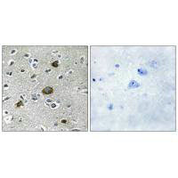 Immunohistochemistry analysis of paraffin-embedded human brain tissue using AKAP1 antibody.Rabbit anti-Human AKAP1 Polyclonal Antibody