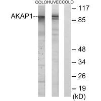 Western blot analysis of extracts from HUVEC cells and COLO cells, using AKAP1 antibody.Rabbit anti-Human AKAP1 Polyclonal Antibody