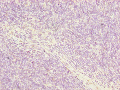 Immunohistochemistry of paraffin-embedded human thymus tissue using POSTN Antibody at dilution of 1:100Rabbit anti-Human POSTN Polyclonal Antibody