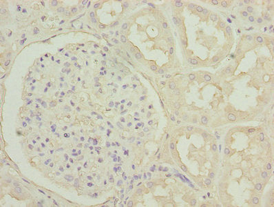 Immunohistochemistry of paraffin-embedded human kidney tissue using POSTN Antibody at dilution of 1:100Rabbit anti-Human POSTN Polyclonal Antibody