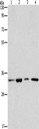 Gel: 8%SDS-PAGE, Lysate: 40 μg, Lane 1-4: 231 cells, human fetal brain tissue, NIH/3T3 cells, PC3 cells, Primary antibody: ARPC2 Antibody(ARPC2 Antibody) at dilution 1/350, Secondary antibody: Goat anti rabbit IgG at 1/8000 dilution, Exposure time: 40 secondsRabbit anti-Human ARPC2 Polyclonal Antibody