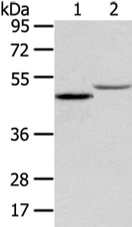 Gel: 8%SDS-PAGE, Lysate: 40 μg, Lane 1-2: Mouse adrenal gland and kidney tissue, Primary antibody: TTC23 Antibody(TTC23 Antibody) at dilution 1/400 dilution, Secondary antibody: Goat anti rabbit IgG at 1/8000 dilution, Exposure time: 20 secondsRabbit anti-Human TTC23 Polyclonal Antibody