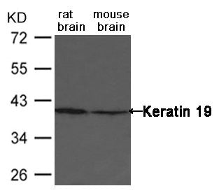 Western blot analysis of extract from rat and mouse brain tissue using Keratin 19 Antibody