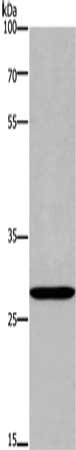 Gel: 8%SDS-PAGE, Lysate: 40 μg, Lane: Raji cells, Primary antibody: ANP32C Antibody(ANP32C Antibody) at dilution 1/400, Secondary antibody: Goat anti rabbit IgG at 1/8000 dilution, Exposure time: 20 secondsRabbit anti-Human ANP32C Polyclonal Antibody
