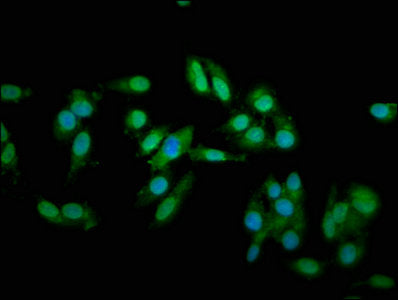 Immunofluorescence staining of Hela cells with TNNT2 Antibody at 1:66, counter-stained with DAPI. The cells were fixed in 4% formaldehyde, permeabilized using 0.2% Triton X-100 and blocked in 10% normal Goat Serum. The cells were then incubated with the antibody overnight at 4°C. The secondary antibody was Alexa Fluor 488-congugated AffiniPure Goat Anti-Rabbit IgG(H+L).Rabbit anti-Human TNNT2 Polyclonal Antibody