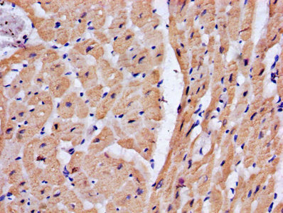 IHC image of TNNT2 Antibody diluted at 1:200 and staining in paraffin-embedded human heart tissue performed on a Leica BondTM system. After dewaxing and hydration, antigen retrieval was mediated by high pressure in a citrate buffer (pH 6.0). Section was blocked with 10% normal goat serum 30min at RT. Then primary antibody (1% BSA) was incubated at 4°C overnight. The primary is detected by a biotinylated secondary antibody and visualized using an HRP conjugated SP system.Rabbit anti-Human TNNT2 Polyclonal Antibody