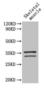 Western Blot  | Positive WB detected in: Mouse skeletal muscle tissue  | All lanes: TNNT2 antibody at 4µg/ml  | Secondary  | Goat polyclonal to rabbit IgG at 1/50000 dilution  | Predicted band size: 36, 35, 32, 31 kDa  | Observed band size: 36, 32 kDaRabbit anti-Human TNNT2 Polyclonal Antibody