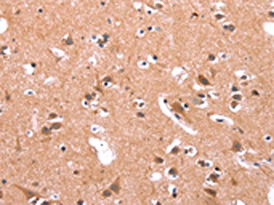 The image on the left is immunohistochemistry of paraffin-embedded Human brain  tissue using GABRA1 Antibody(GABRA1 Antibody) at dilution 1/30, on the right is treated with synthetic peptide. (Original magnification: ×200)Rabbit anti-Human GABRA1 Polyclonal Antibody