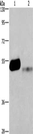 Gel: 8%SDS-PAGE, Lysate: 40 μg, Lane 1-2: Human stomach cancer tissue, LoVo cells, Primary antibody: GABRA1 Antibody(GABRA1 Antibody) at dilution 1/200, Secondary antibody: Goat anti rabbit IgG at 1/8000 dilution, Exposure time: 10 minutesRabbit anti-Human GABRA1 Polyclonal Antibody