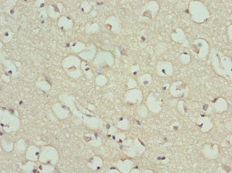 Immunohistochemistry of paraffin-embedded human brain tissue using the antibody at dilution of 1:100Rabbit anti-Human PYGB Polyclonal Antibody