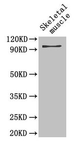 Western Blot  | Positive WB detected in: Mouse skeletal muscle tissue  | All lanes: PYGB antibody at 4µg/ml  | Secondary  | Goat polyclonal to rabbit IgG at 1/50000 dilution  | Predicted band size: 97 kDa  | Observed band size: 97 kDaRabbit anti-Human PYGB Polyclonal Antibody