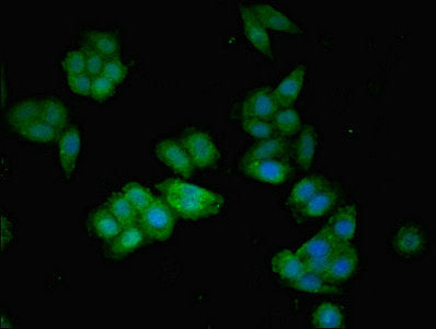 Immunofluorescent analysis of HepG2 cells using the antibody at dilution of 1:100 and Alexa Fluor 488-congugated AffiniPure Goat Anti-Rabbit IgG(H+L)Rabbit anti-Human AGT Polyclonal Antibody