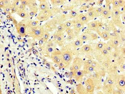 IHC image of AGT Antibody diluted at 1:400 and staining in paraffin-embedded human liver tissue performed on a Leica BondTM system. After dewaxing and hydration, antigen retrieval was mediated by high pressure in a citrate buffer (pH 6.0). Section was blocked with 10% normal goat serum 30min at RT. Then primary antibody (1% BSA) was incubated at 4°C overnight. The primary is detected by a biotinylated secondary antibody and visualized using an HRP conjugated SP system.Rabbit anti-Human AGT Polyclonal Antibody