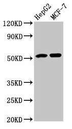Western Blot  | Positive WB detected in: HepG2 whole cell lysate, MCF-7 whole cell lysate  | All lanes: AGT antibody at 3.9µg/ml  | Secondary  | Goat polyclonal to rabbit IgG at 1/50000 dilution  | Predicted band size: 54 kDa  | Observed band size: 54 kDaRabbit anti-Human AGT Polyclonal Antibody