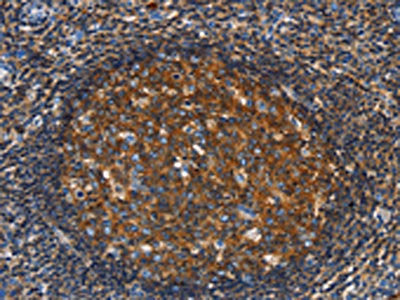 The image on the left is immunohistochemistry of paraffin-embedded Human tonsil tissue using the antibody Antibody) at dilution 1/30, on the right is treated with fusion protein. (Original magnification: ×200)Rabbit anti-Human GNA13 Polyclonal Antibody