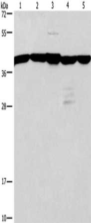 Gel: 15%SDS-PAGE, Lysate: 40 μg, Lane 1-5: A172 cells, 293T cells, mouse kidney tissue, human testis tissue, Human brain malignant glioma tissue, Primary antibody: GNA13 Antibody(GNA13 Antibody) at dilution 1/600, Secondary antibody: Goat anti rabbit IgG at 1/8000 dilution, Exposure time: 10 secondsRabbit anti-Human GNA13 Polyclonal Antibody