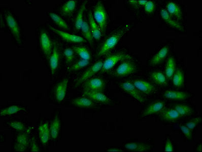 Immunofluorescence staining of Hela cells with MSLN Antibody at 1:100, counter-stained with DAPI. The cells were fixed in 4% formaldehyde, permeabilized using 0.2% Triton X-100 and blocked in 10% normal Goat Serum. The cells were then incubated with the antibody overnight at 4°C. The secondary antibody was Alexa Fluor 488-congugated AffiniPure Goat Anti-Rabbit IgG(H+L).Rabbit anti-Human MSLN Polyclonal Antibody