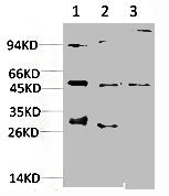 Western blot analysis of 1) Hela Cell Lysate, 2)PC12 Cell Lysate, 3) C2C12 Cell Lysate using JNK2 Rabbit pAb diluted at 1:1000.