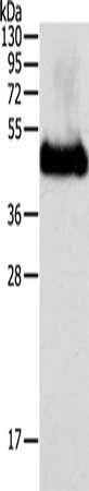 Gel: 12%SDS-PAGE, Lysate: 50 μg, Lane: 823 cells, Primary antibody: PGC Antibody(PGC Antibody) at dilution 1/200, Secondary antibody: Goat anti rabbit IgG at 1/8000 dilution, Exposure time: 30 secondsRabbit anti-Human PGC Polyclonal Antibody
