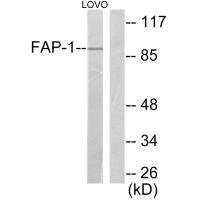 Western blot analysis of extracts from LOVO cells, using FAP-1 antibody.Rabbit anti-Human FAP Polyclonal Antibody
