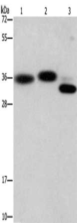 Gel: 15%SDS-PAGE, Lysate: 40 μg, Lane 1-3: Hela cells, mouse brain tissue, Mouse heart tissue, Primary antibody: CAPZA2 Antibody(CAPZA2 Antibody) at dilution 1/650, Secondary antibody: Goat anti rabbit IgG at 1/8000 dilution, Exposure time: 1 minute