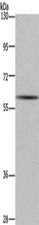 Gel: 6%SDS-PAGE, Lysate: 40 μg, Lane: Human fetal brain tissue, Primary antibody: GAD1 Antibody(GAD1 Antibody) at dilution 1/571, Secondary antibody: Goat anti rabbit IgG at 1/8000 dilution, Exposure time: 1 minuteRabbit anti-Human GAD1 Polyclonal Antibody