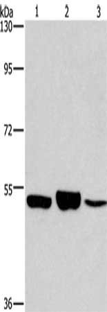 Gel: 8%SDS-PAGE, Lysate: 40 μg, Lane 1-3: 231 cells, mouse kidney tissue, Mouse lung tissue, Primary antibody: IRF6 Antibody(IRF6 Antibody) at dilution 1/400, Secondary antibody: Goat anti rabbit IgG at 1/8000 dilution, Exposure time: 5 minutes