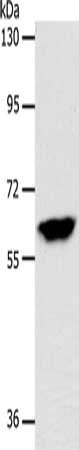 Gel: 8%SDS-PAGE, Lysate: 40 μg, Lane: Mouse brain tissue, Primary antibody: INA Antibody(INA Antibody) at dilution 1/500, Secondary antibody: Goat anti rabbit IgG at 1/8000 dilution, Exposure time: 1 minuteRabbit anti-Human INA Polyclonal Antibody