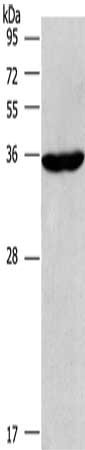 Gel: 6%SDS-PAGE, Lysate: 40 μg, Lane: Raji cells, Primary antibody: CIAPIN1 Antibody(CIAPIN1 Antibody) at dilution 1/597, Secondary antibody: Goat anti rabbit IgG at 1/8000 dilution, Exposure time: 2 minutesRabbit anti-Human CIAPIN1 Polyclonal Antibody