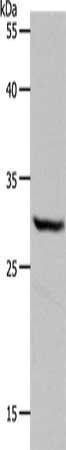 Gel: 10%SDS-PAGE, Lysate: 40 μg, Lane: Hela cells, Primary antibody: NQO1 Antibody(NQO1 Antibody) at dilution 1/600, Secondary antibody: Goat anti rabbit IgG at 1/8000 dilution, Exposure time: 30 secondsRabbit anti-Human NQO1 Polyclonal Antibody