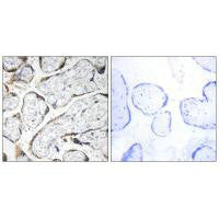 Immunohistochemistry analysis of paraffin-embedded human placenta tissue using EFEMP2 antibody.Rabbit anti-Human EFEMP2 Polyclonal Antibody