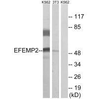 Western blot analysis of extracts from K562 cells and 3T3 cells, using EFEMP2 antibody.Rabbit anti-Human EFEMP2 Polyclonal Antibody