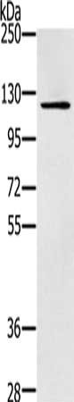 Gel: 6%SDS-PAGE, Lysate: 40 μg, Lane: Skov3 cells, Primary antibody: ZMIZ1 Antibody(ZMIZ1 Antibody) at dilution 1/200, Secondary antibody: Goat anti rabbit IgG at 1/8000 dilution, Exposure time: 2 minutesRabbit anti-Human ZMIZ1 Polyclonal Antibody
