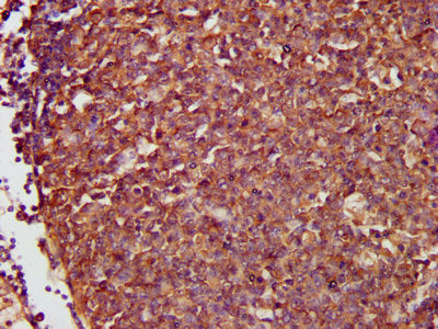 IHC image of NFKB1 Antibody diluted at 1:500 and staining in paraffin-embedded human lymph node tissue performed on a Leica BondTM system. After dewaxing and hydration, antigen retrieval was mediated by high pressure in a citrate buffer (pH 6.0). Section was blocked with 10% normal goat serum 30min at RT. Then primary antibody (1% BSA) was incubated at 4°C overnight. The primary is detected by a biotinylated secondary antibody and visualized   using an HRP conjugated SP system.Rabbit anti-Human NFKB1 Polyclonal Antibody