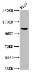 Western Blot  | Positive WB detected in: Raji whole cell lysate  | All lanes: NFKB1 antibody at 3.75µg/ml  | Secondary  | Goat polyclonal to rabbit IgG at 1/50000 dilution  | Predicted band size: 106, 86 kDa  | Observed band size: 106 kDaRabbit anti-Human NFKB1 Polyclonal Antibody