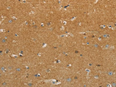 The image on the left is immunohistochemistry of paraffin-embedded Human brain tissue using the antibody Antibody) at dilution 1/30, on the right is treated with synthetic peptide. (Original magnification: ×200)Rabbit anti-Human GJB6 Polyclonal Antibody